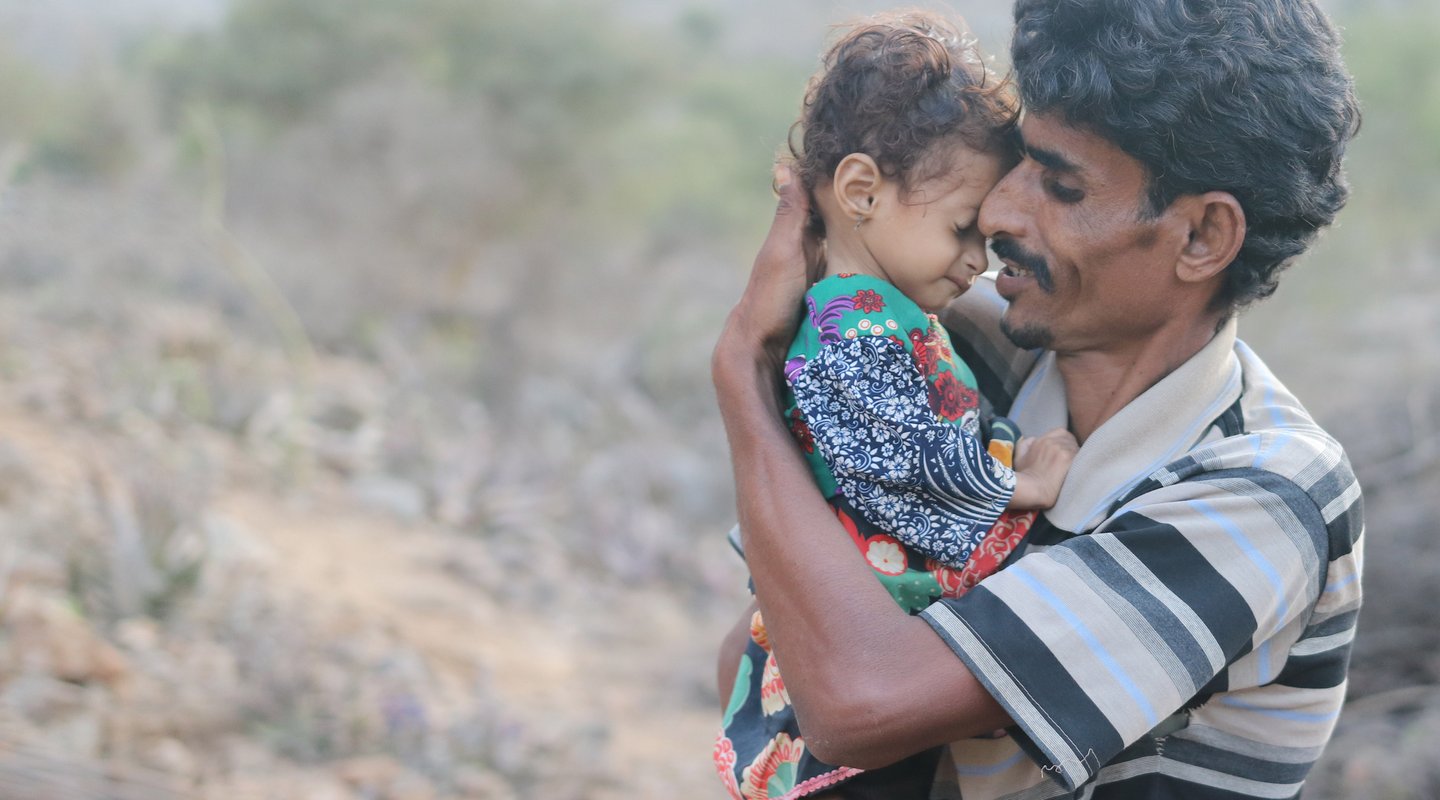 Ali, a father of two from Yemen whose children are suffering from malnutrition.